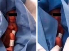 Barbosa exige despido del médico que dio por muerto a bebé