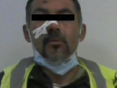 Inician proceso penal contra sujeto que lesionó a dos masculinos
