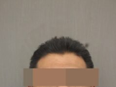 Imponen sentencia de 16 años de cárcel a agresor sexual de dos mujeres