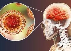 QIAGEN presenta panel molecular que detecta 15 patógenos de meningitis en una hora