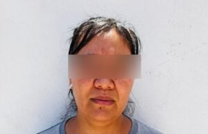 Ejerce FDZN acción penal contra pareja que causó quemaduras a un niño